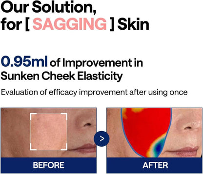 MEDIHEAL Collagen Ampoule Pad 100P