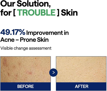 MEDIHEAL Teatree Trouble Pad 100P