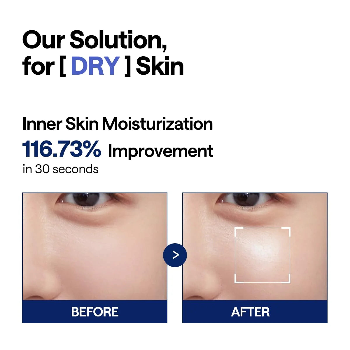 MEDIHEAL Watermide Moisture Pad 100P